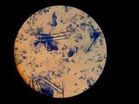 S��wasserschwamm