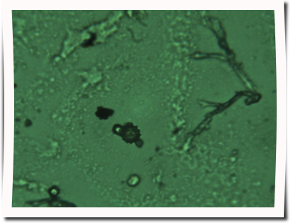 L&ouml;wenzahnPollen&Ouml;sterreich